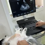 超音波診断装置（エコー）