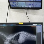 レントゲン写真・説明用モニター